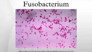 Fusobacterium [upl. by Saxet]