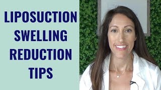 Liposuction Healing amp Recovery Tips  How to REDUCE Lipo Swelling  Post Liposuction Care Guide [upl. by Adiaros488]