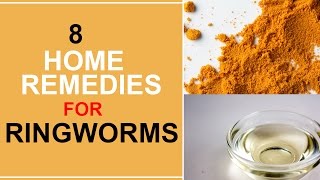 8 Home Remedies For Ringworms [upl. by Lindsley]