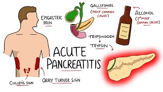 Assessment for Abdominal Ascites [upl. by Eniamrej]