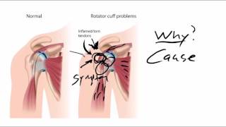 Peroneal Tendonitis  Home Stretches and Exercise Rehabilitation Plan [upl. by Haroun894]