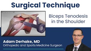 Biceps Tenodesis in the Shoulder Surgical Technique [upl. by Naman]