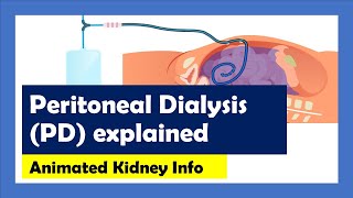 Peritoneal Dialysis explained [upl. by Orban628]