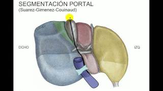 Segmentacion hepática [upl. by Lacagnia433]