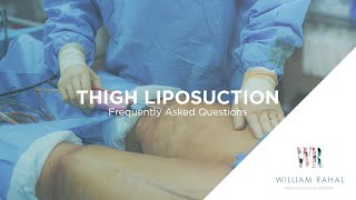 Thigh Liposuction Recovery amp other FAQs Frequently Asked Questions [upl. by Kneeland]