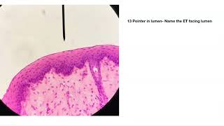 Epithelial Tissue Practice quiz [upl. by Otrebogir]