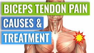 Biceps Tendonitis Treatment and Exercises Explained [upl. by Ydeh41]