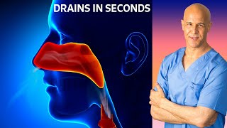 Dr Mandells Sinus Drainage Trick [upl. by Cherie]