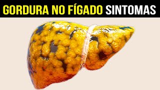 10 Sintomas de Gordura no Fígado CUIDADO COM ESSES SINAIS [upl. by Tiat]