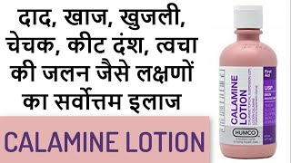 Calamine lotion  Superb remedy for mild skin infections [upl. by Sillyhp]