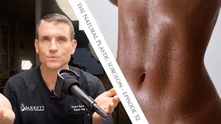 32 Everything You Need To Know About Liposuction [upl. by Ykroc609]