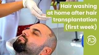 Hair Washing Procedure at Home After Hair Transplantation First Week  Tutorial [upl. by Pauiie]