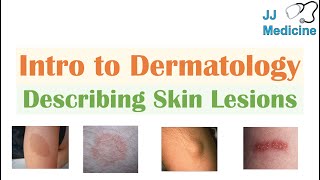 Introduction to Dermatology  The Basics  Describing Skin Lesions Primary amp Secondary Morphology [upl. by Tice74]