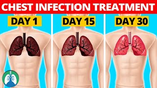 7 Natural Chest Infection Treatments Home Remedies [upl. by Nagiam]