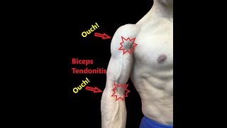 Biceps Tendonitis Treatment At Home Relieve Pain Fast [upl. by Natelson]