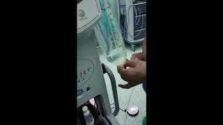 Boston Scientific Angiojet SetUp [upl. by Attirehs]