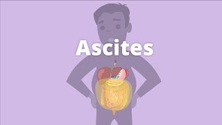 Ascites  Definition Causes Pathophysiology Diagnosis Management SAAG  Abdominal Distension [upl. by Aivekahs]