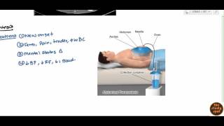 Ascites for USMLE Step 2 [upl. by Aiynat550]