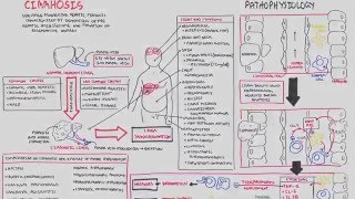 Liver Cirrhosis SandS Pathophysiology Investigations Management [upl. by Ogg]