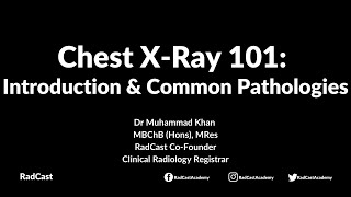 RadCast Academy Introduction To The Chest XRay amp Common Pathologies cxr radcast [upl. by Keifer455]