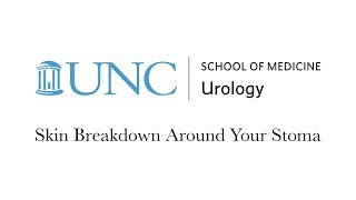 Skin Breakdown Around Your Stoma [upl. by Odama]