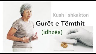 GURET NE TEMTH idhëz  Ushqimet qe nuk lejohen  Si sherohen guret e temthit  idhzes  Biliare [upl. by Salisbarry]