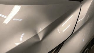 PDR Aluminum Hood Dent [upl. by Tiloine827]