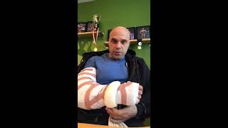 Week 1  Recovery Following Distal Bicep Tendon Tear Surgery [upl. by Vidovik353]