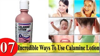 7 Incredible Ways To Use Calamine Lotion [upl. by Oibesue]