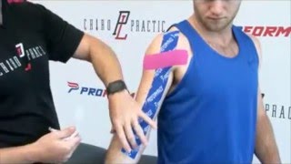 How to Apply PF Performance Tape  Bicep Tendon [upl. by Alioz]