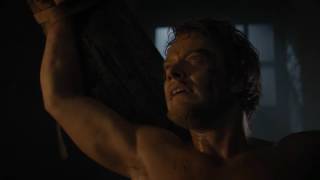 Game of Thrones Theons poor leg YTP [upl. by Almond]