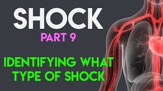 Identifying What Type Shock  Shock Part 9 [upl. by Kathe798]