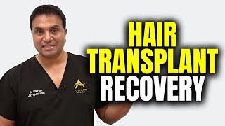 What To Expect After A Hair Transplant [upl. by Hui]