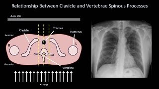 How to Read a Chest Xray like a Radiologist My Search Pattern [upl. by Premer]