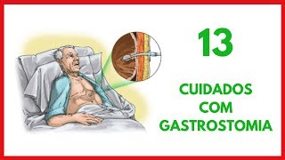 Cuidados de Enfermagem com Gastrostomia [upl. by Eberto]