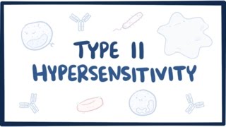 Type II hypersensitivity cytotoxic hypersensitivity  causes symptoms amp pathology [upl. by Eiznyl220]