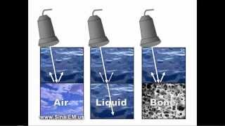 Ultrasound Basics [upl. by Minny]