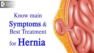 What is Hernia Symptoms Causes Types Treatment  Dr Harish N S  Doctors Circle [upl. by Octavian668]