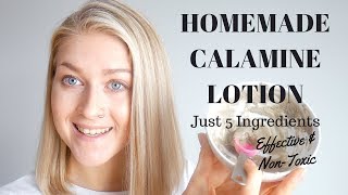 5 Ingredient DIY Calamine Lotion amp Powder  Homemade Calamine Lotion [upl. by Mulac774]