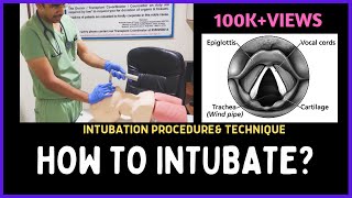 HOW TO INTUBATE INTUBATION PROCEDURE amp TECHNIQUE [upl. by Volin]