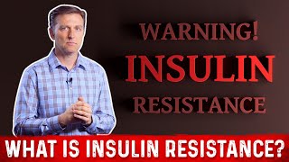 What Is Insulin Resistance – Dr Berg [upl. by Mckale]