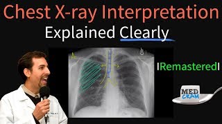 XRay Scanner Pro free app for Android [upl. by Malinde]