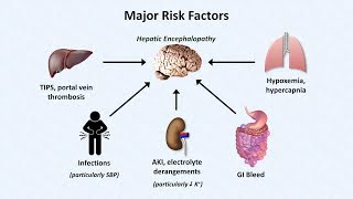 Hepatic Encephalopathy [upl. by Stephenson307]