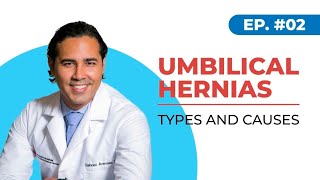 Umbilical Hernias Types and Causes Houston Texas [upl. by Vinson126]