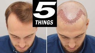 5 THINGS to do after HAIR TRANSPLANT [upl. by Irual488]