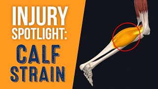 Injury Spotlight Calf Strain [upl. by Asiluj]