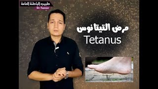 التيتانوس  Tetanus [upl. by Garret646]