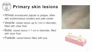 4 Primary and Secondary skin lesions [upl. by Siravat]